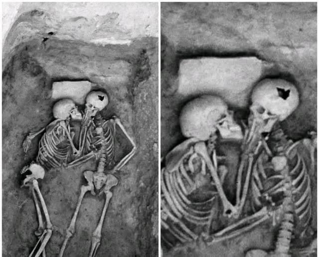 Scientific illustration marking trauma locations