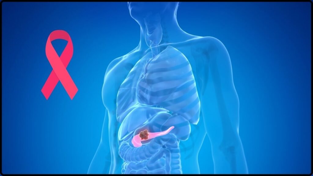 Study Identifies ALK7 Receptor Linked to Rapid Pancreatic Cancer Spread