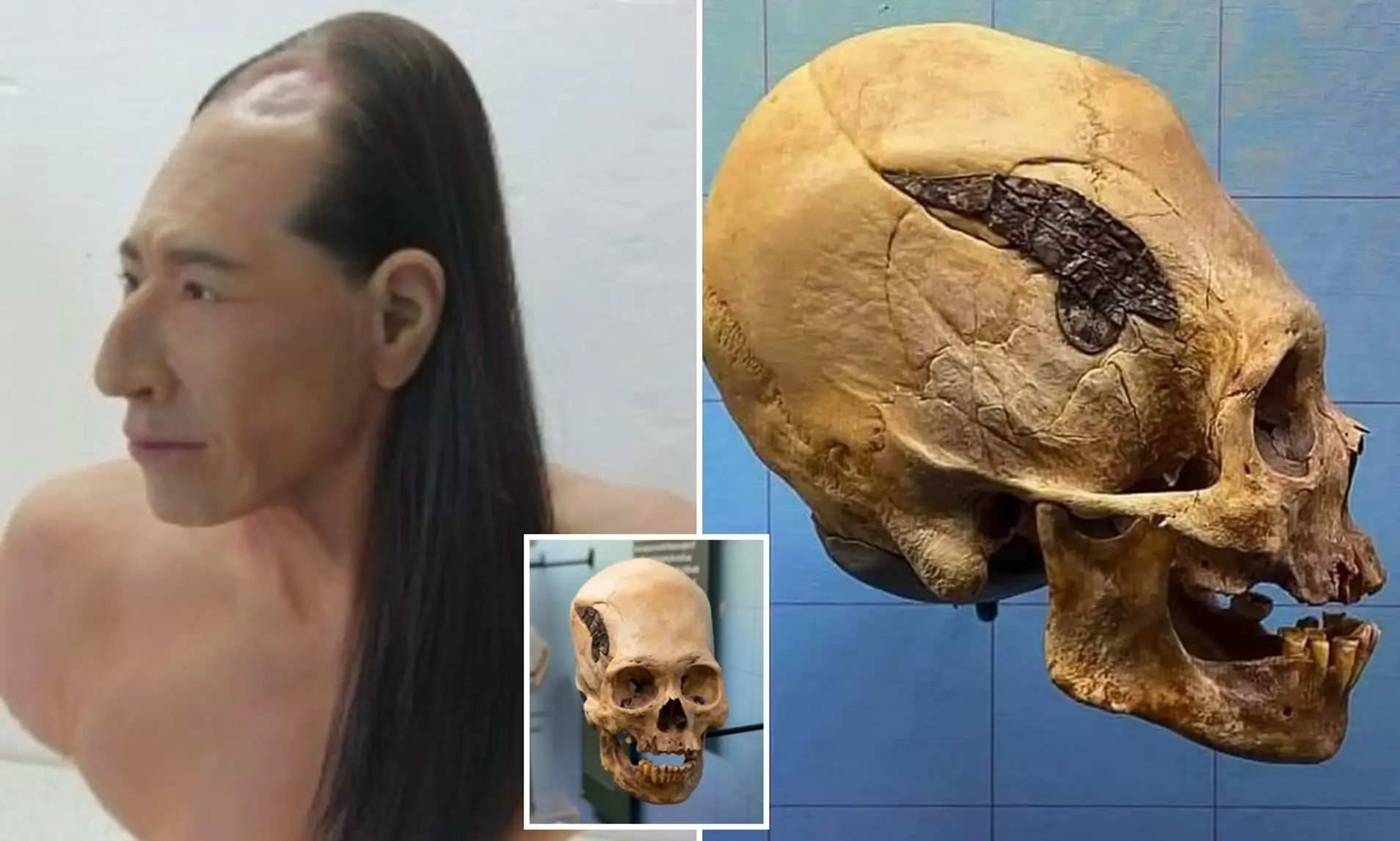 DNA From Peru’s Elongated Skulls
